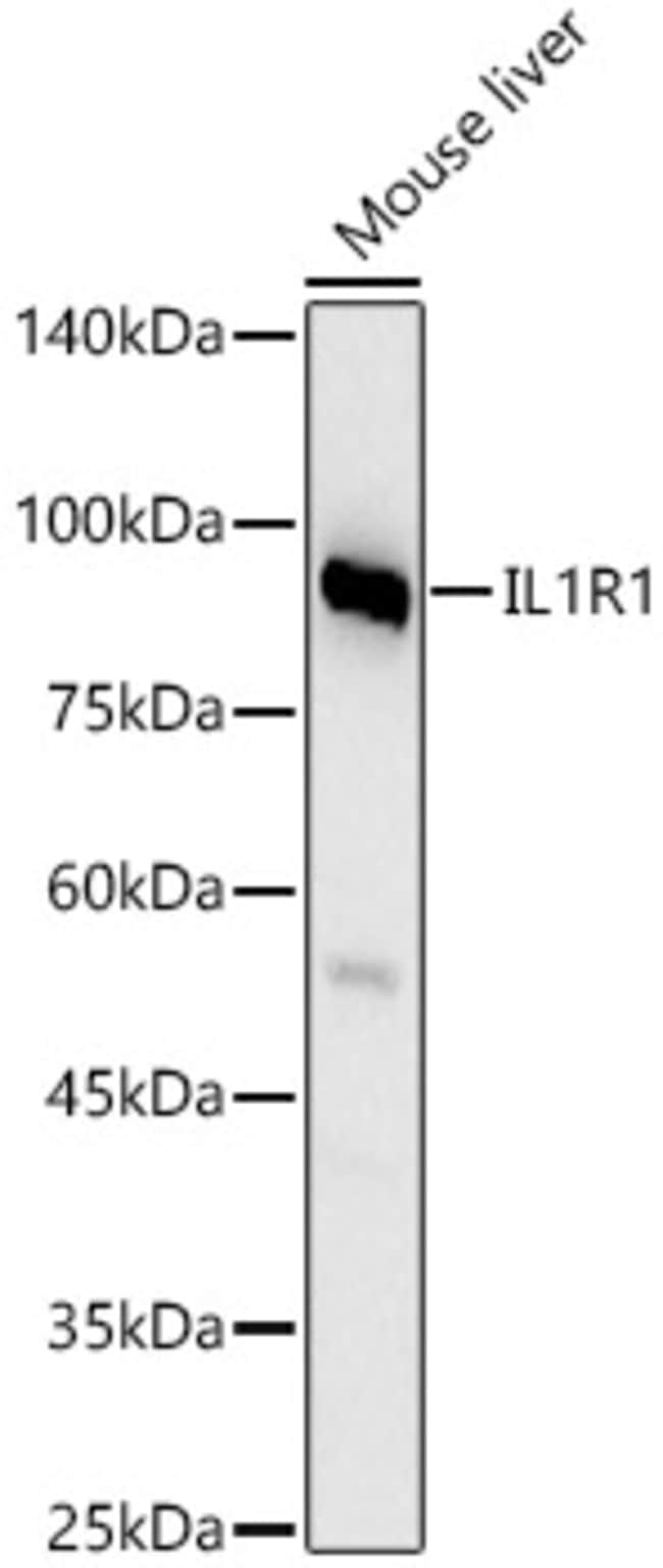 100UL IL1R1 ANTIBODY 100 ul