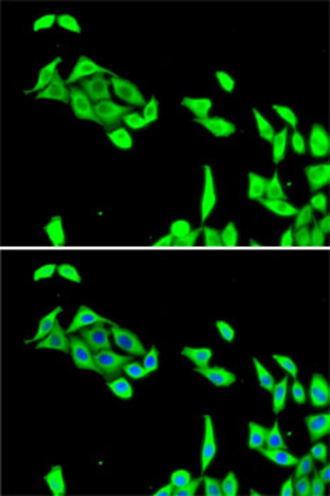100UL CDK5 ANTIBODY 100 ul