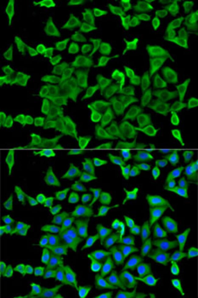 100UL ARP2 ANTIBODY 100 ul