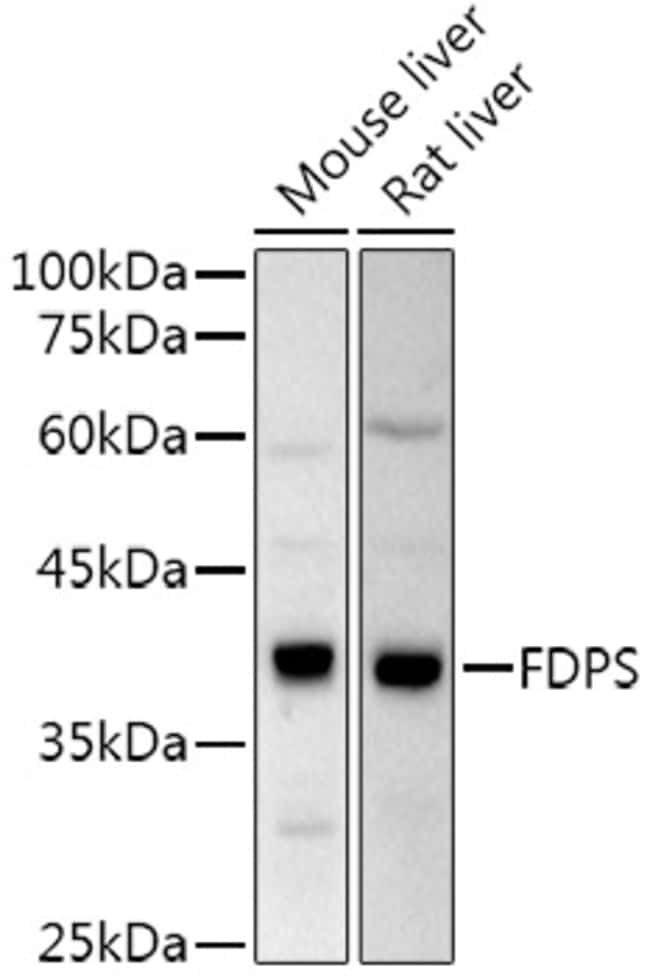 100UL FDPS ANTIBODY 100 ul
