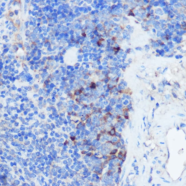 100UL IFNGR1 ANTIBODY 100 ul