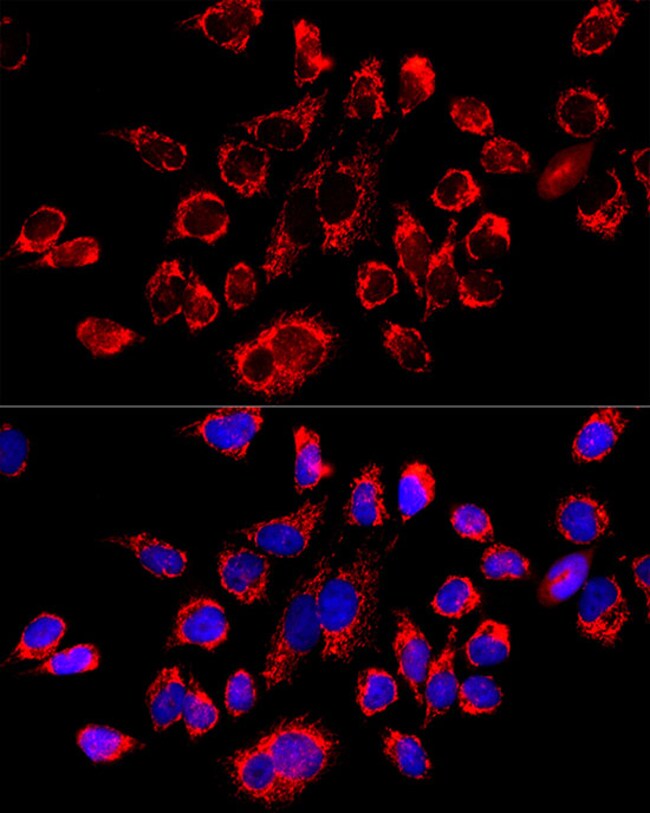 100UL ATP SYNTHASE BETA ANTIBODY 100 ul