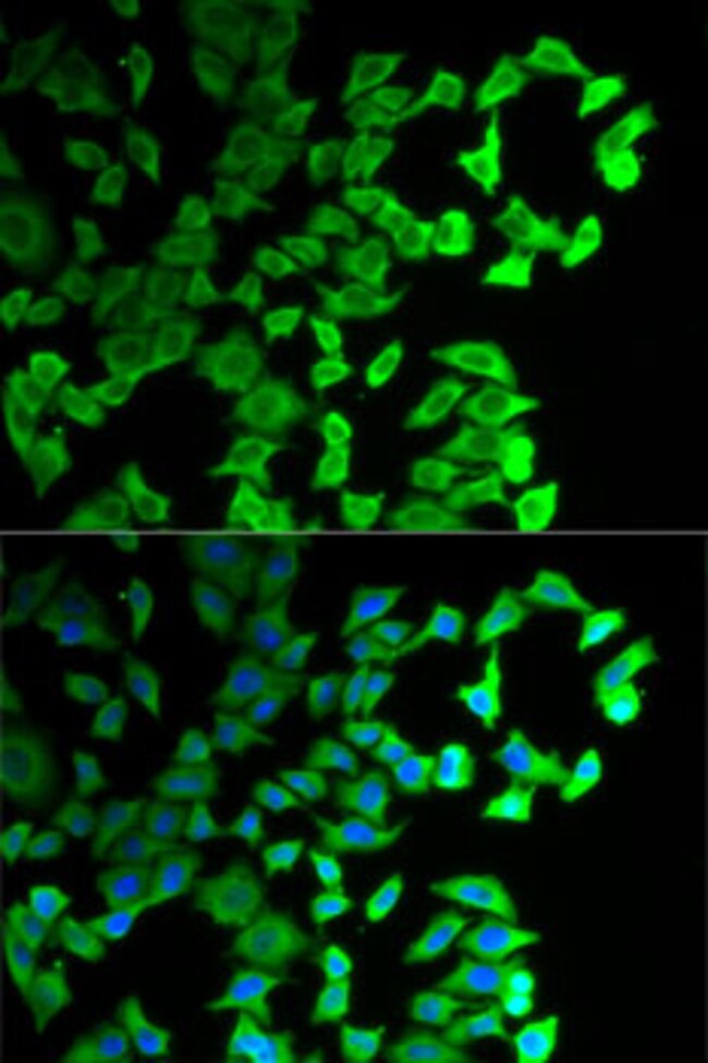 100UL DIAPH1 ANTIBODY 100 ul