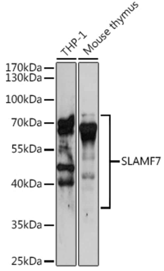 100UL CD319 (CRACC) ANTIBODY 100 ul