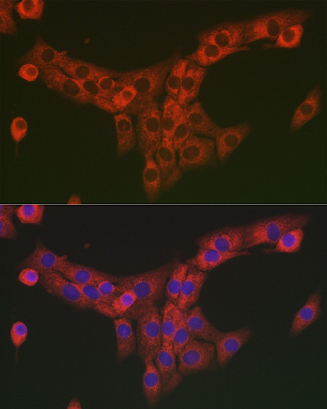 100UL COL1A2 ANTIBODY 100 ul