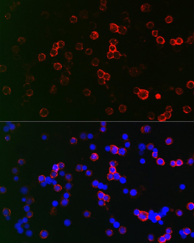 100UL CD22 ANTIBODY 100 ul