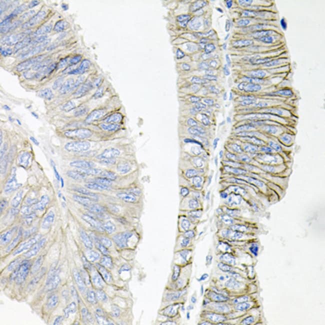 100UL ATP1B1 ANTIBODY 100 ul