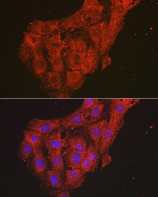 100UL CXCL1 ANTIBODY 100 ul