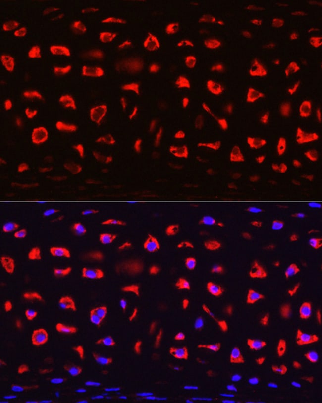 100UL COMP ANTIBODY 100 ul