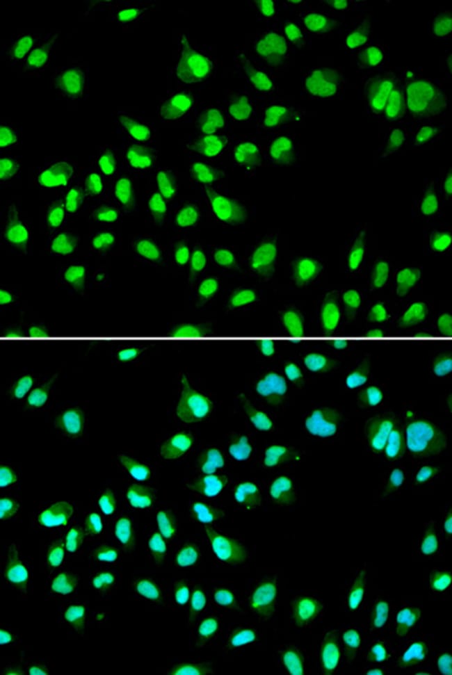 100UL GTF2F2 ANTIBODY 100 ul