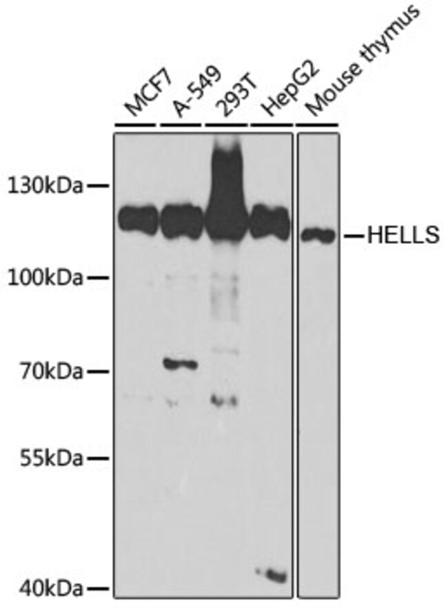 100UL HELLS ANTIBODY 100 ul