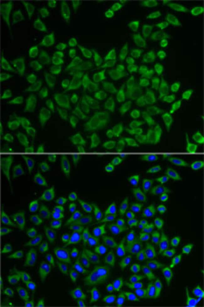 100UL MRPS30 ANTIBODY 100 ul
