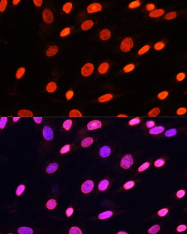 100UL DI-METHYL-LYSINE ANTIBODY 100 ul