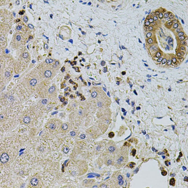 100UL KTN1 ANTIBODY 100 ul