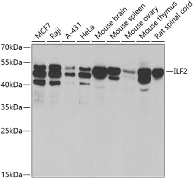 100UL ILF2 ANTIBODY 100 ul