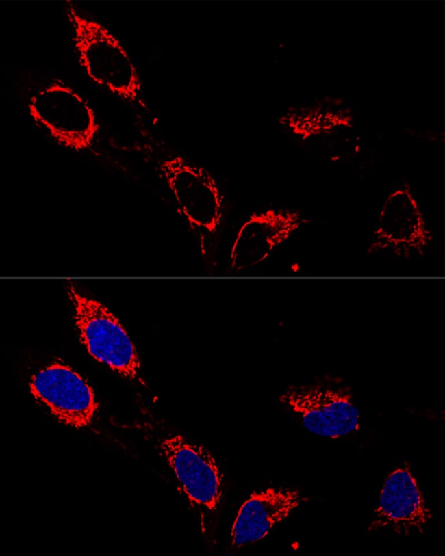 100UL ATP5A1 ANTIBODY 100 ul
