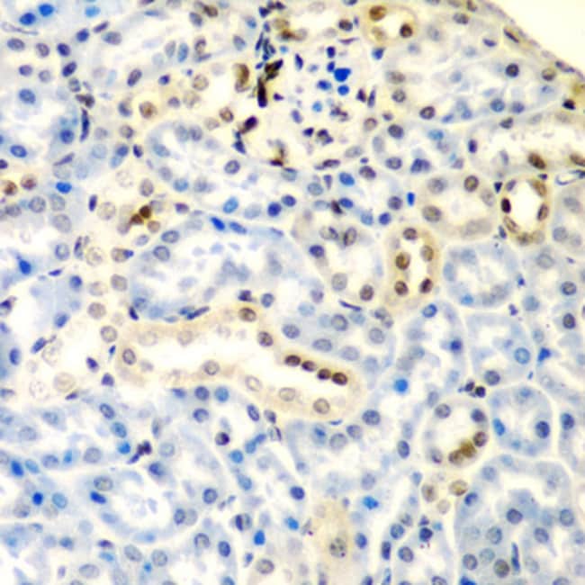 100UL DCTD ANTIBODY 100 ul