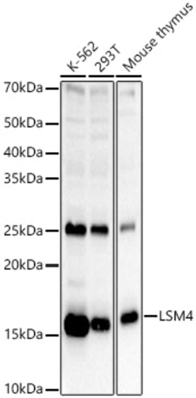 100UL LSM4 ANTIBODY 100 ul