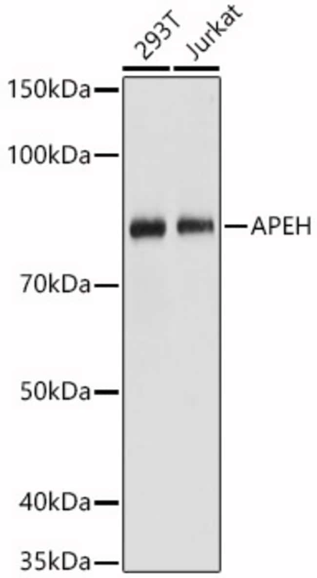 100UL APEH ANTIBODY 100 ul