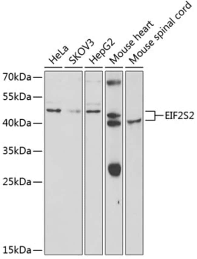 100UL EIF2 BETA ANTIBODY 100 ul