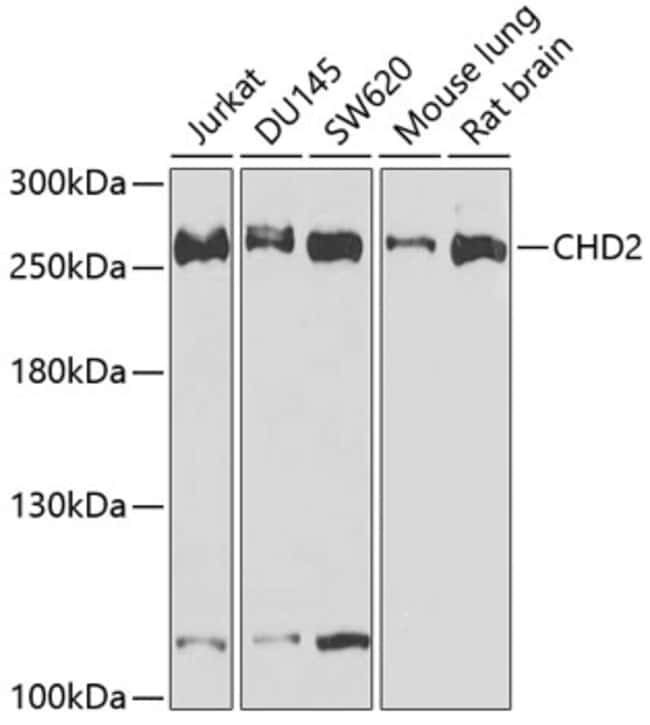 100UL CHD2 ANTIBODY 100 ul