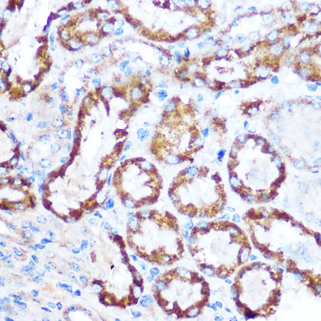 100UL MAP4 ANTIBODY 100 ul
