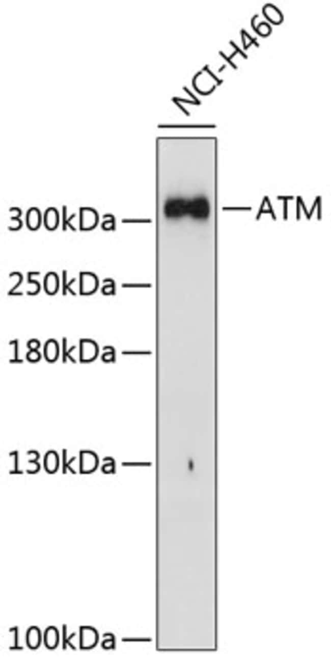 100UL ATM ANTIBODY 100 ul
