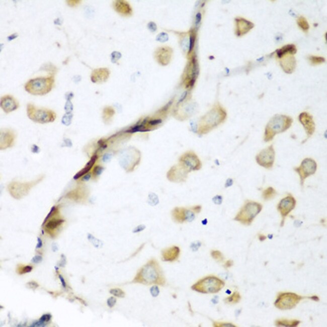 100UL ELAVL2 ANTIBODY 100 ul