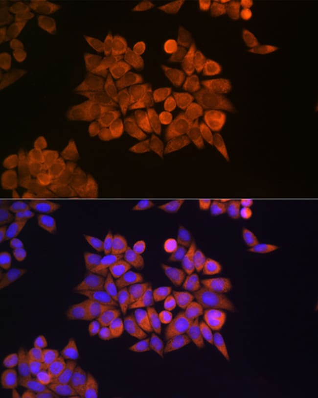 100UL ERF1 ANTIBODY 100 ul