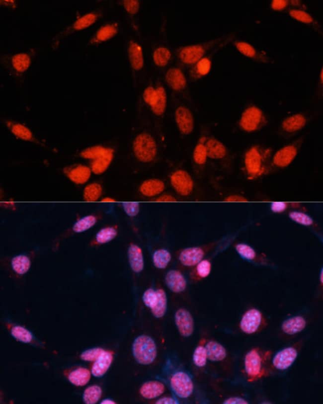 100UL FUS ANTIBODY 100 ul