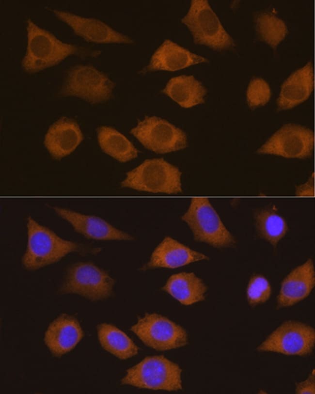100UL CSDE1 ANTIBODY 100 ul