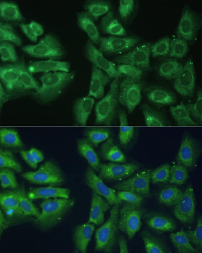 100UL EIF3D ANTIBODY 100 ul