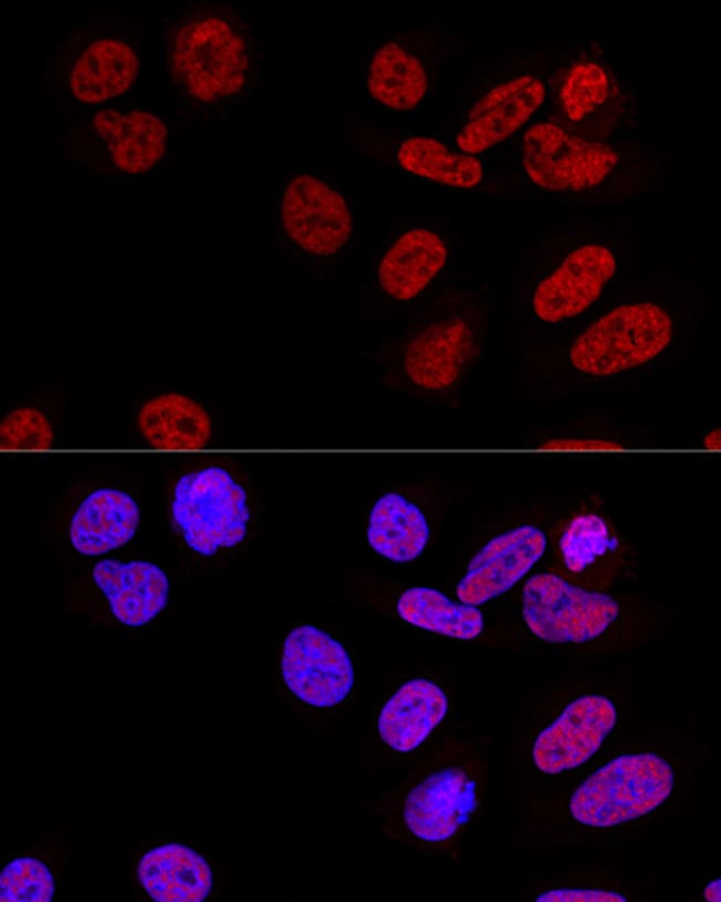 100UL CPSF6 ANTIBODY 100 ul
