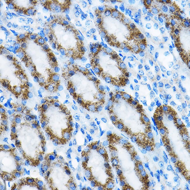 100UL MRPL13 ANTIBODY 100 ul