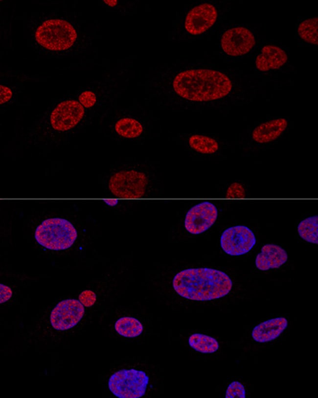 100UL ALY ANTIBODY 100 ul