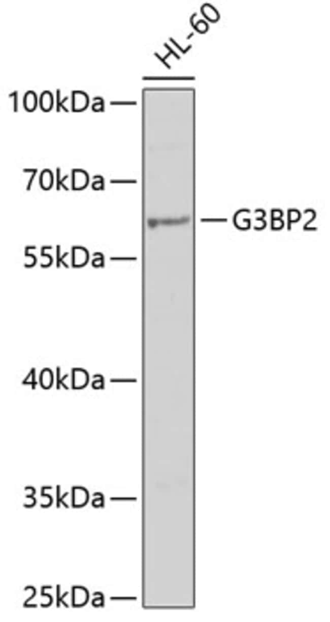 100UL G3BP2 ANTIBODY 100 ul