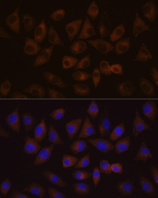 100UL HDLBP ANTIBODY 100 ul