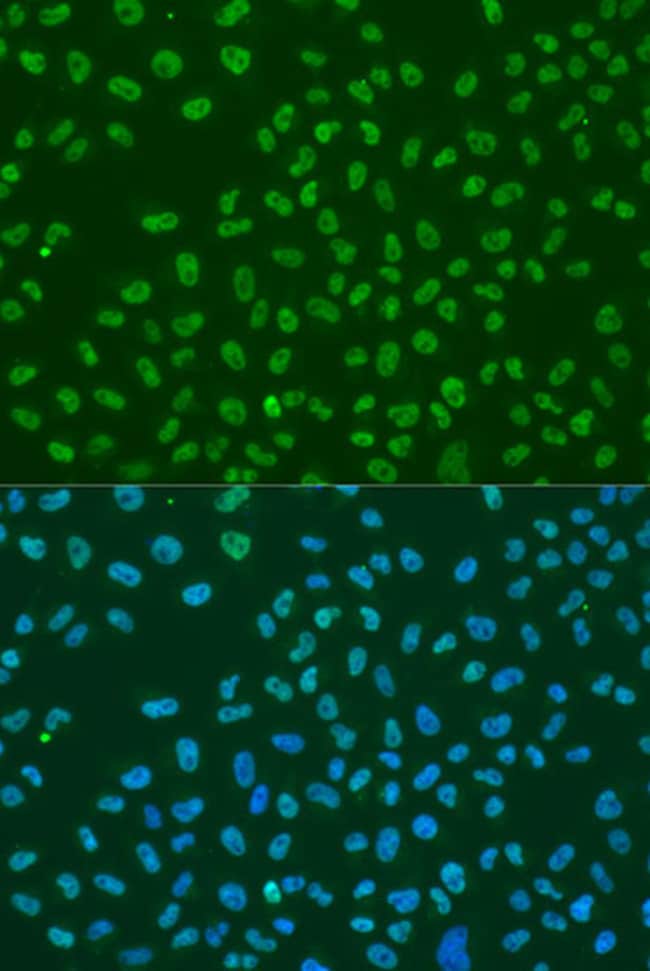 100UL HUR ANTIBODY 100 ul