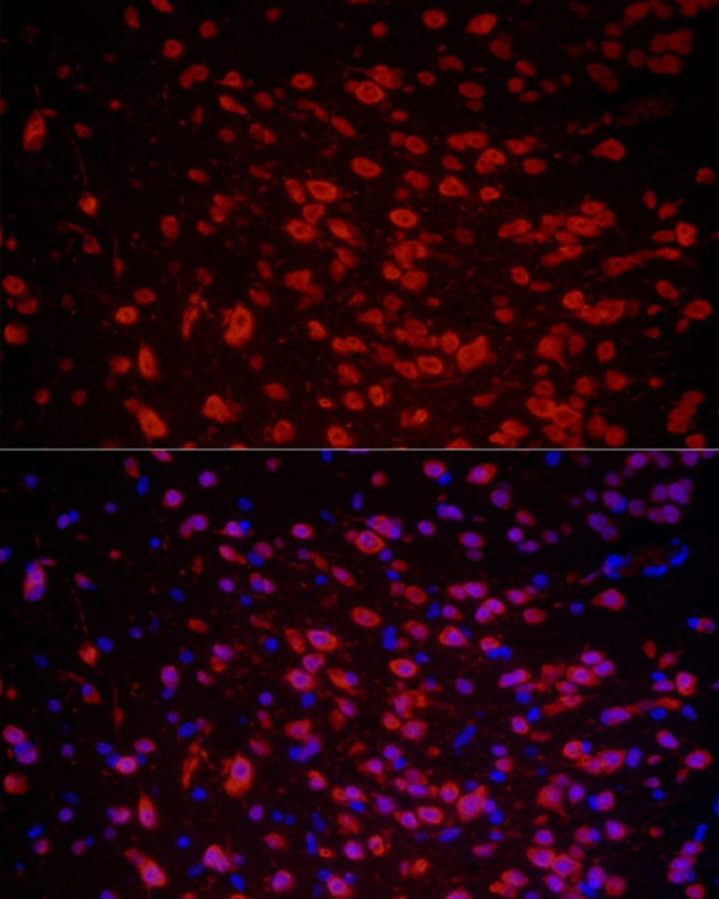 100UL HUC ANTIBODY 100 ul
