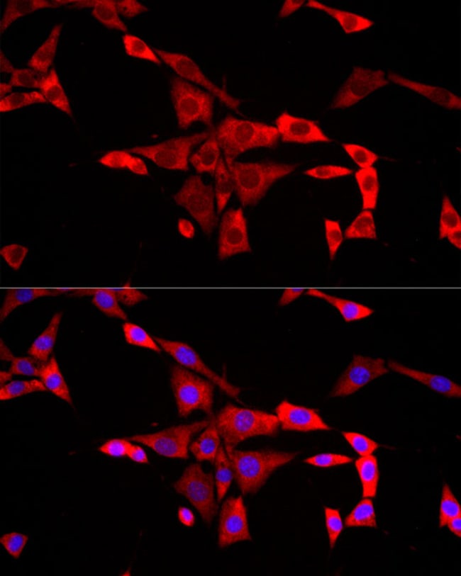 100UL FMRP ANTIBODY 100 ul