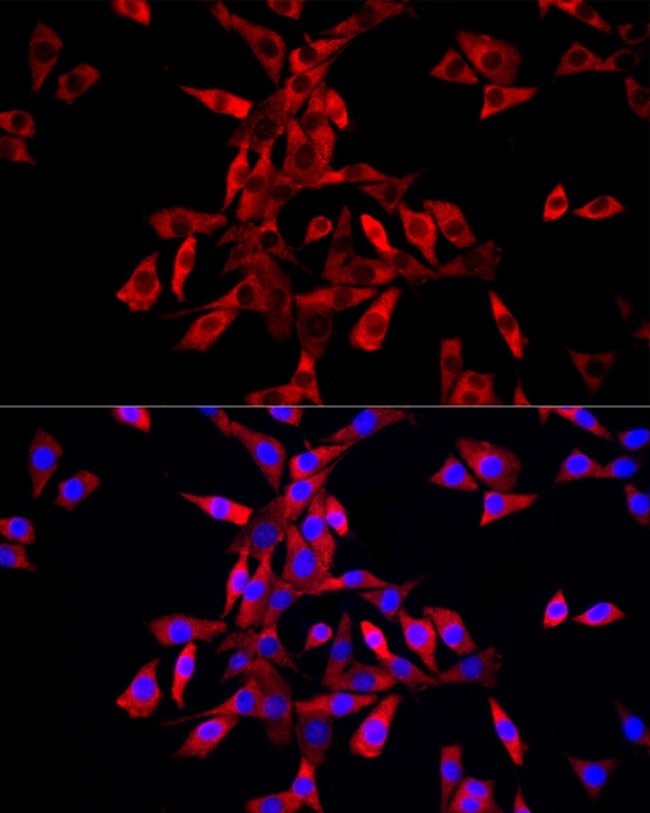 100UL IGF2BP3 ANTIBODY 100 ul