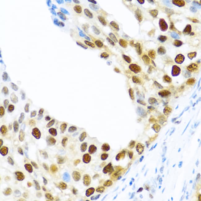 100UL KHDRBS2 ANTIBODY 100 ul