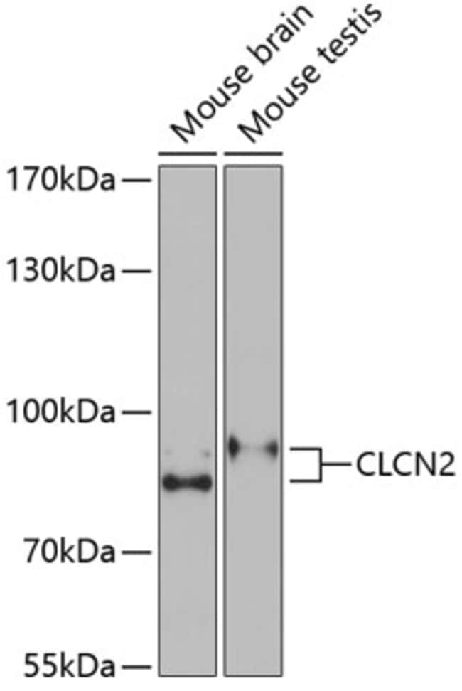 100UL CLCN2 ANTIBODY 100 ul