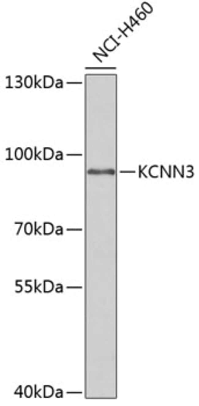 100UL KCNN3 ANTIBODY 100 ul
