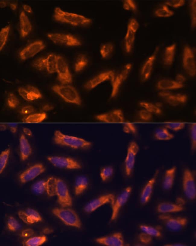 100UL GM-CSF ANTIBODY 100 ul