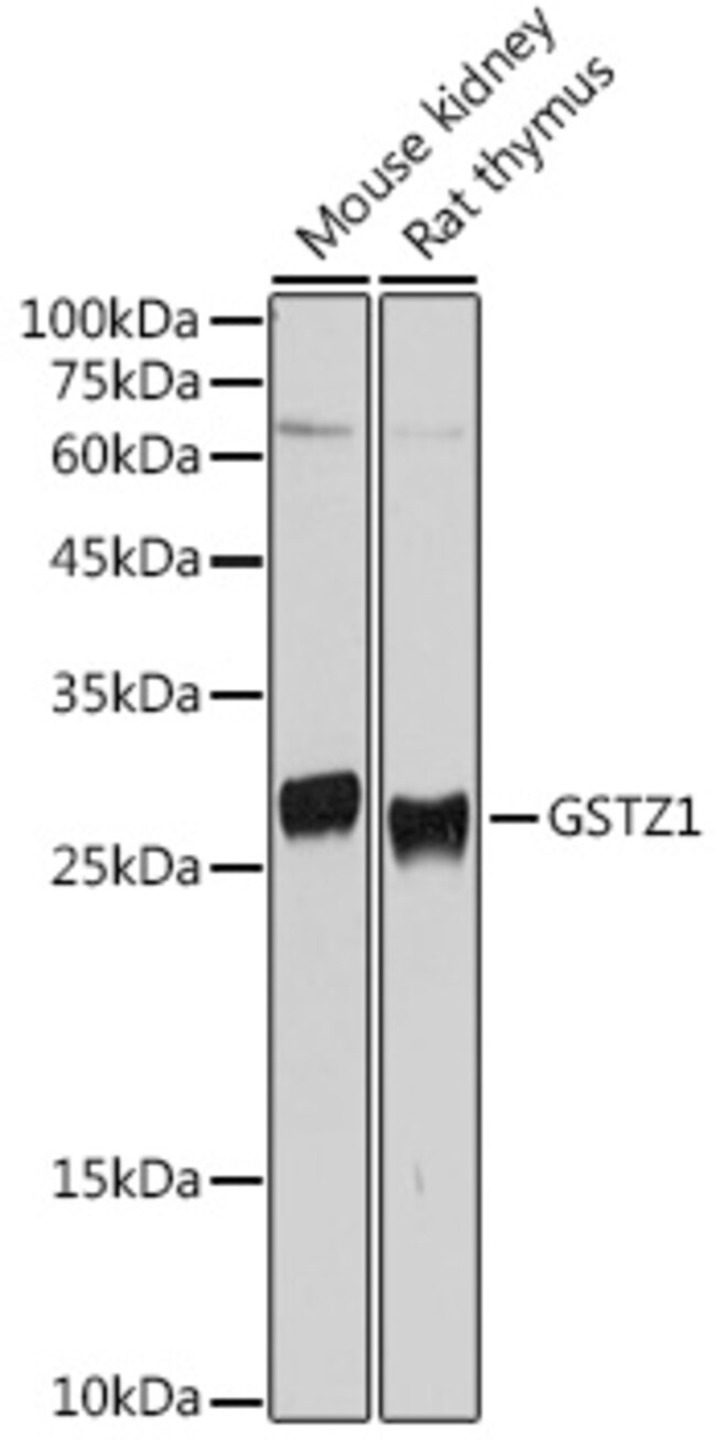 100UL GSTZ1 ANTIBODY 100 ul
