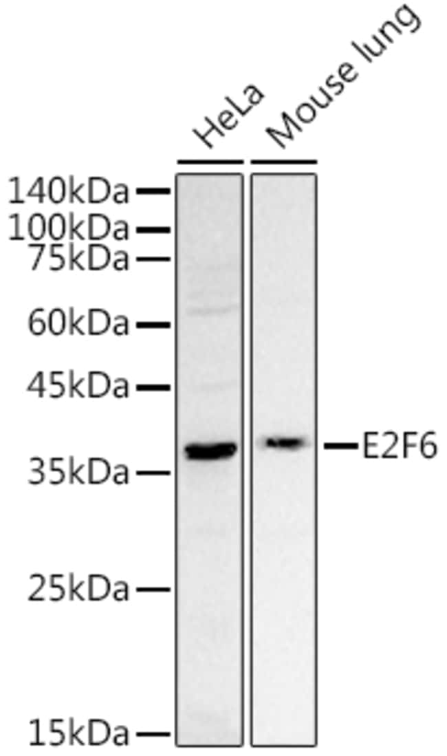 100UL E2F6 ANTIBODY 100 ul