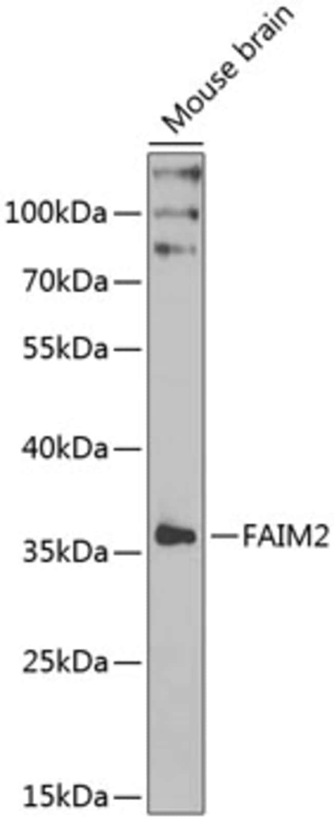 100UL LFG ANTIBODY 100 ul