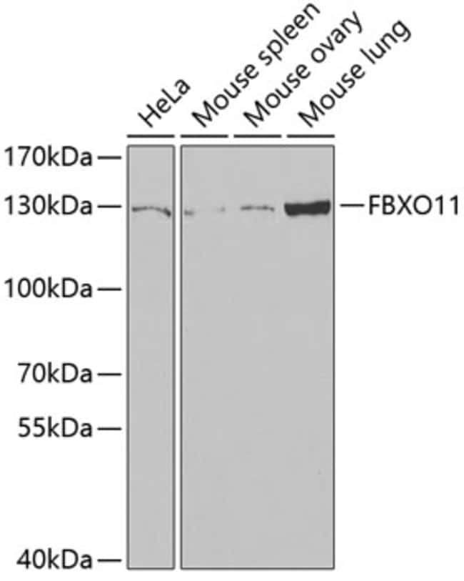 100UL FBXO11 ANTIBODY 100 ul