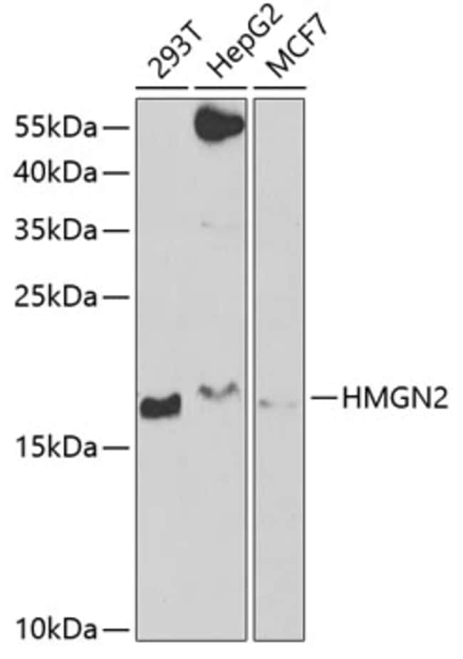 100UL HMGN2 ANTIBODY 100 ul